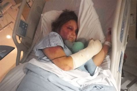 kirra hart getting beat up video|Teen victim of brutal alleged bashing speaks out。